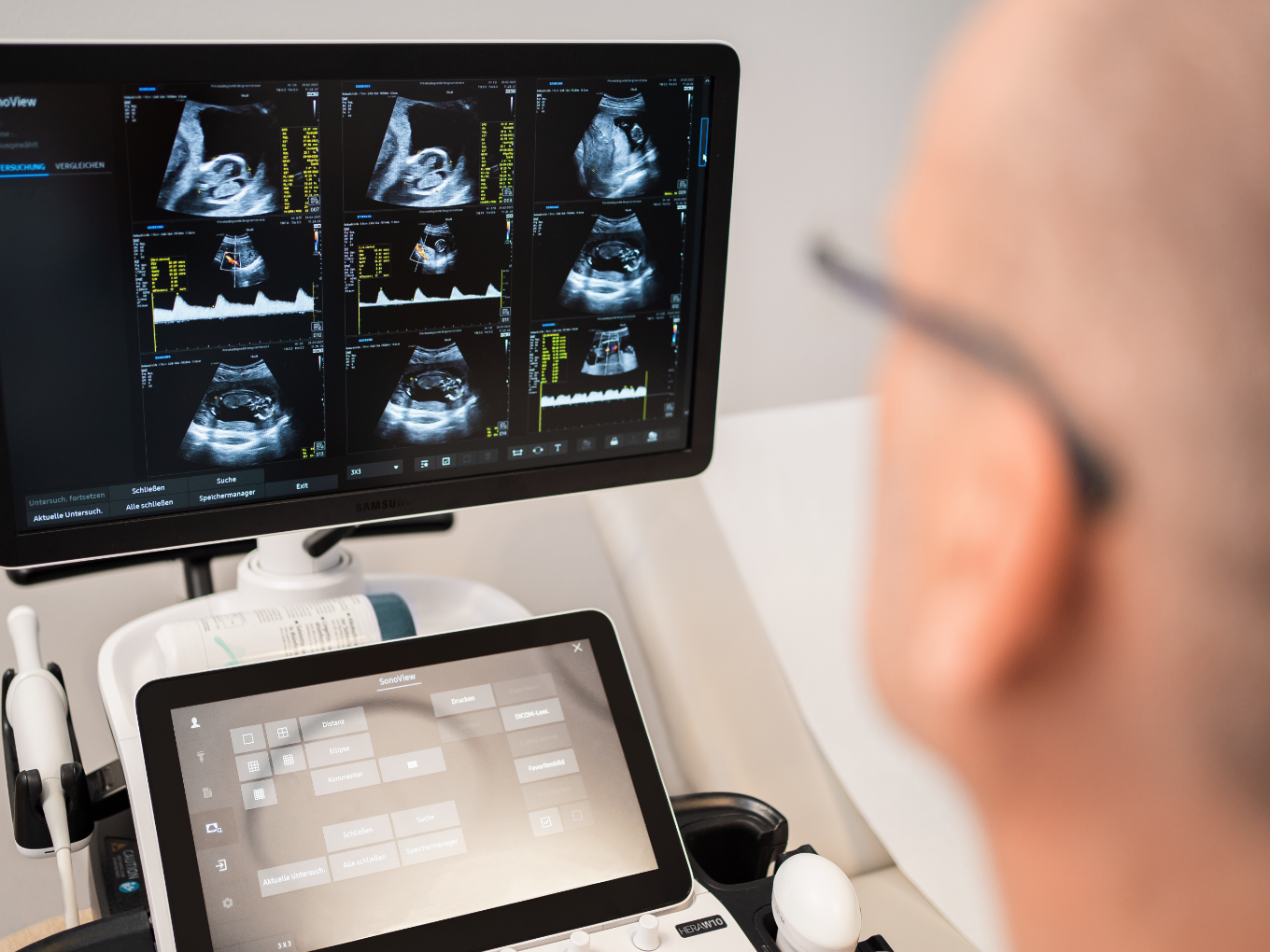 Arzt mit Brille sieht sich Bilder einer Ultraschalluntersuchung am Gerät an
